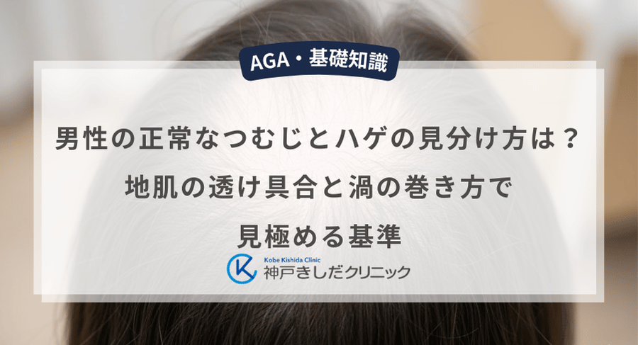 男性の正常なつむじとハゲの見分け方は？地肌の透け具合と渦の巻き方で見極める基準