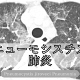 ニューモシスチス肺炎（PCP, Pneumocystis pneumonia）