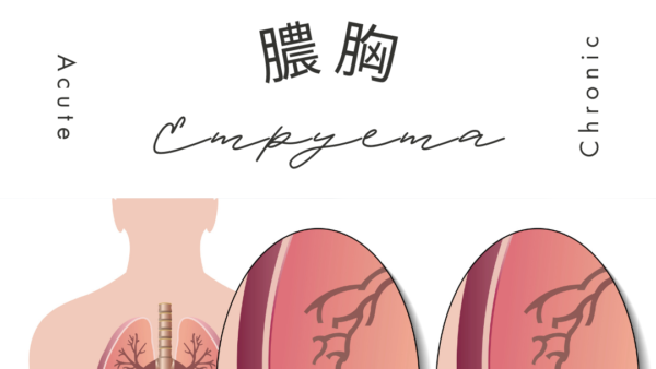 膿胸 （Empyema） – 呼吸器疾患