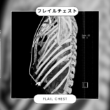 フレイルチェスト(動揺胸郭 flail chest) – 呼吸器疾患