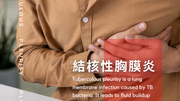 結核性胸膜炎（Tuberculous pleurisy/pleuritis） – 呼吸器疾患