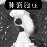 肺嚢胞症(Pulmonary cystic disease) – 呼吸器疾患