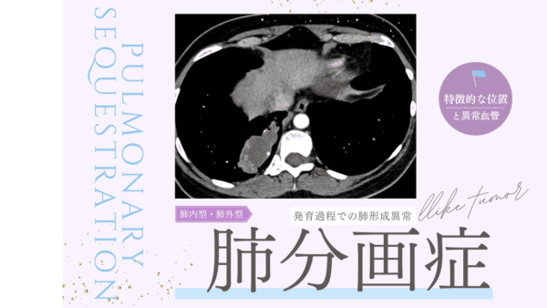 肺分画症(Pulmonary sequestration) – 呼吸器疾患