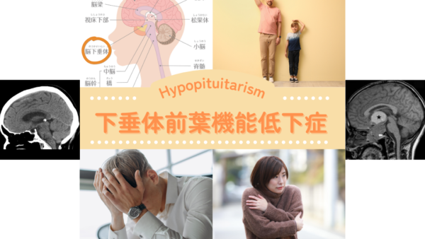 下垂体前葉機能低下症（Hypopituitarism） – 内分泌疾患