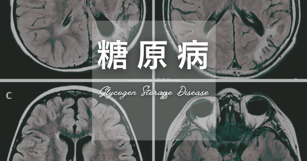 糖原病（GSD: Glycogen Storage Disease） – 代謝疾患