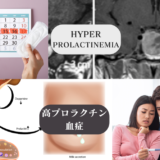 高プロラクチン血症（Hyperprolactinemia） – 内分泌疾患