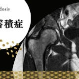 脂質蓄積症（リピドーシス: Lipidosis） – 代謝疾患