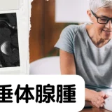 下垂体腺腫（Pituitary adenoma） – 内分泌疾患