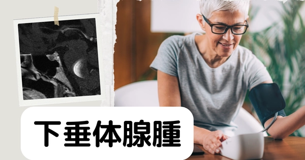 下垂体腺腫（Pituitary adenoma） – 内分泌疾患