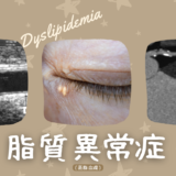 脂質異常症: Dyslipidemia（高脂血症: Hyperlipidemia） – 代謝疾患