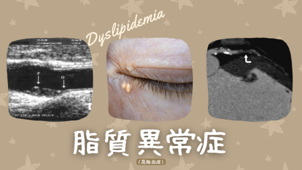 脂質異常症: Dyslipidemia（高脂血症: Hyperlipidemia） – 代謝疾患