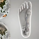 糖尿病足病変(Diabetic foot) - 代謝疾患