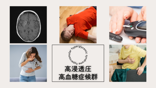 高浸透圧高血糖症候群（HHS: hyperosmolar hyperglycemic syndrome） – 代謝疾患