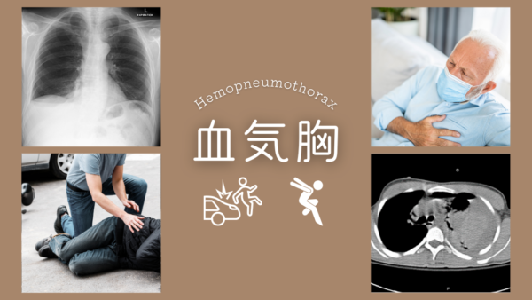 血気胸（Hemopneumothorax） – 呼吸器疾患