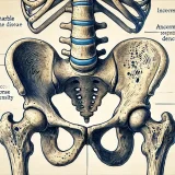 大理石骨病 （osteopetrosis）– 代謝疾患
