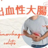 出血性大腸炎（Hemorrhagic colitis） – 感染症