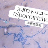 スポロトリコーシス（Sporotrichosis） – 感染症