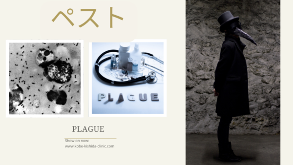 ペスト（Plague） – 感染症