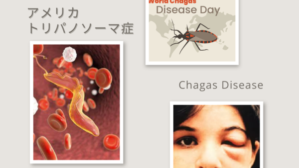 アメリカトリパノソーマ症（シャーガス病 / Chagas Disease）- 感染症