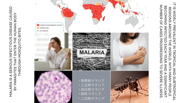 マラリア（Malaria） – 感染症