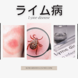 ライム病（Lyme disease） – 感染症