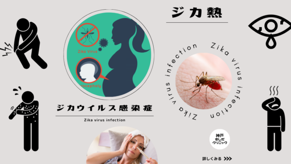 ジカ熱（ジカウイルス感染症）（Zika virus infection） – 感染症