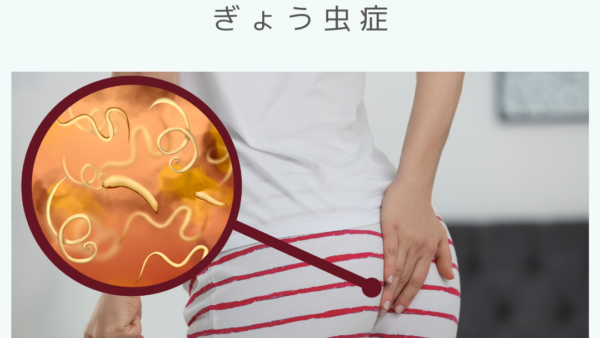 ぎょう虫症（Pinworm infection） – 感染症