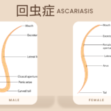 回虫症（Ascariasis） – 感染症