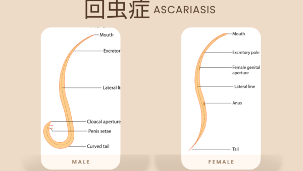 回虫症（Ascariasis） – 感染症