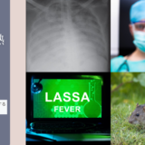 ラッサ熱（Lassa fever） – 感染症