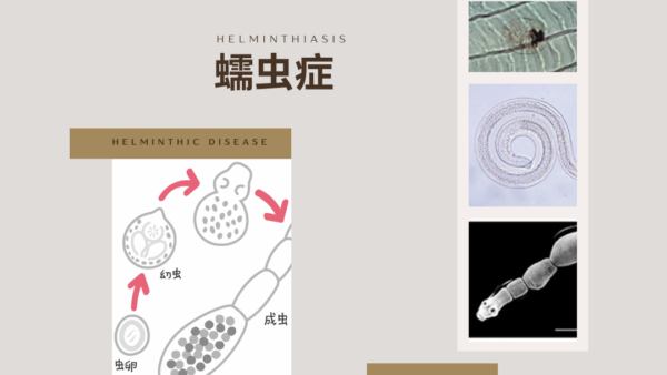 蠕虫（Helminth） – 感染症