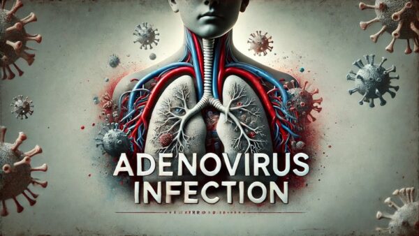 アデノウイルス感染症（Adenovirus infection） – 感染症