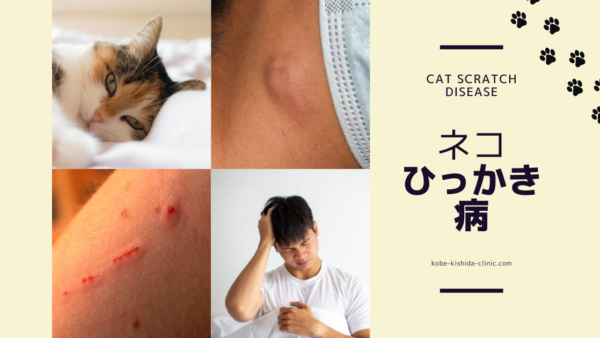 ネコひっかき病（Cat Scratch Disease） – 感染症