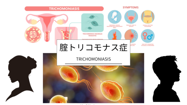 膣トリコモナス症（Trichomoniasis） – 感染症