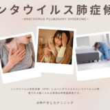 ハンタウイルス肺症候群（Hantavirus Pulmonary Syndrome（HPS） – 感染症