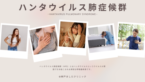 ハンタウイルス肺症候群（Hantavirus Pulmonary Syndrome（HPS） – 感染症