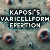 カポジ水痘様発疹症（Kaposi’s varicelliform eruption） – 感染症