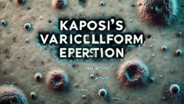 カポジ水痘様発疹症（Kaposi’s varicelliform eruption） – 感染症