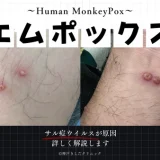 エムポックス（Mpox） – 感染症