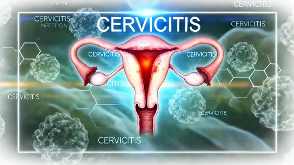 子宮頸管炎（Cervicitis） – 感染症