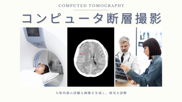 コンピュータ断層撮影（CT検査 / Computed Tomography / CT）