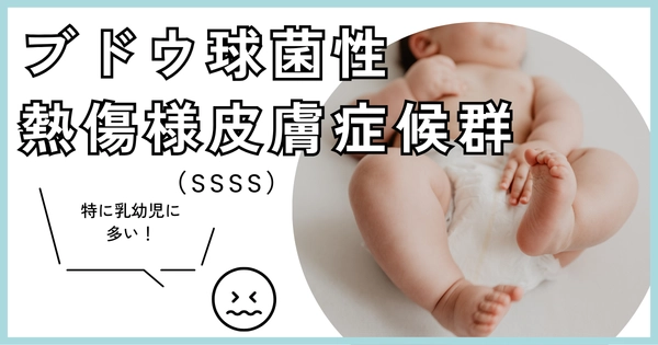 ブドウ球菌性熱傷様皮膚症候群（SSSS）（Staphylococcal scalded skin syndrome） – 感染症