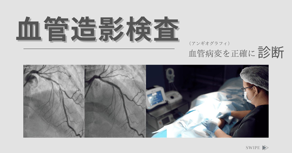 血管造影検査（アンギオグラフィ / Angiography / AG） - 神戸き