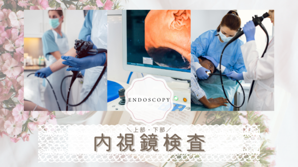 内視鏡検査（Endoscopy）