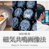 磁気共鳴画像法（MRI検査 / Magnetic Resonance Imaging / MRI）