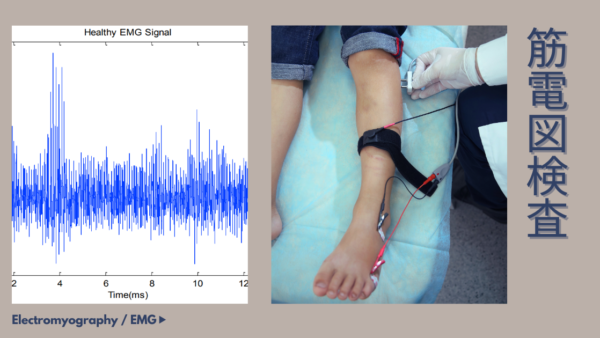 筋電図検査（筋電図 / Electromyography / EMG）