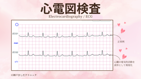 心電図検査（心電図 / Electrocardiography / ECG または EKG）