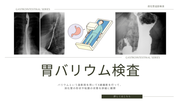 胃バリウム検査（上部消化管造影検査 / Upper Gastrointestinal Series / UGI）