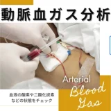 動脈血ガス分析（血液ガス / Arterial Blood Gas / ABG）