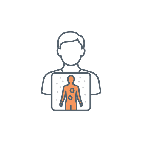 18F-FDG PET/CT